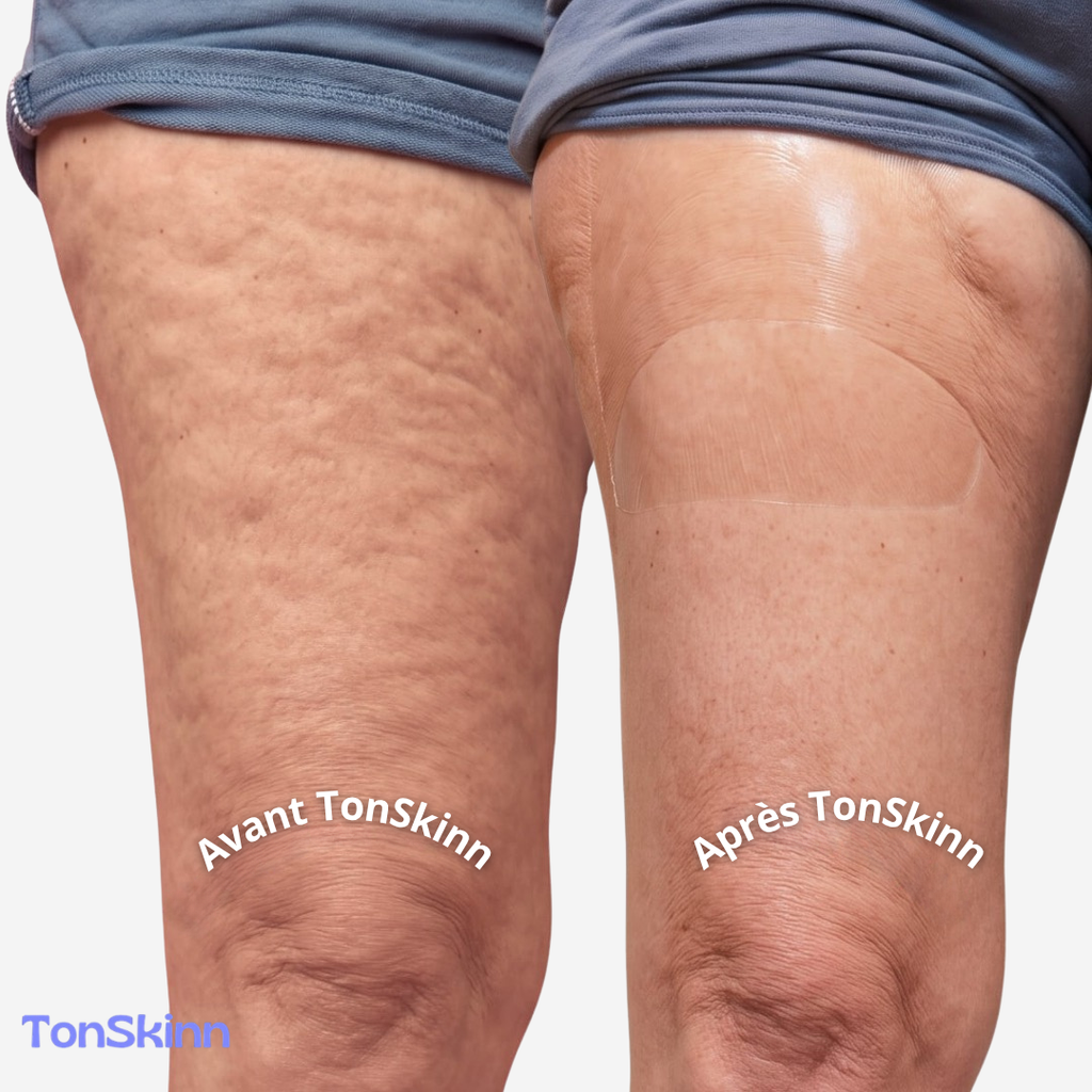 TonSkinn | PATCHS LIFT & SCULPT