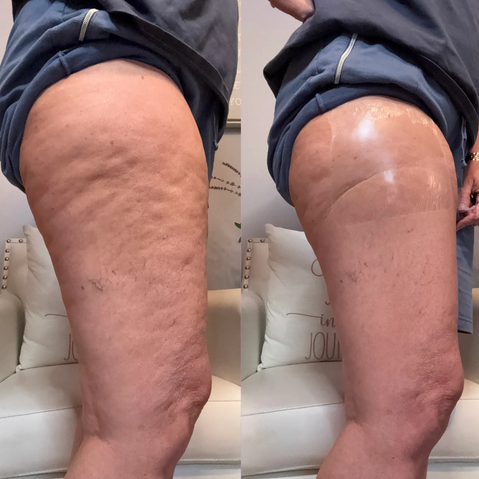 TonSkinn | PATCHS LIFT & SCULPT